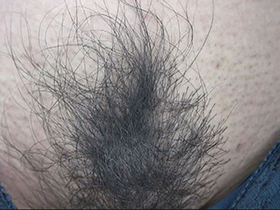 300人のまん毛3　サンプル画像16